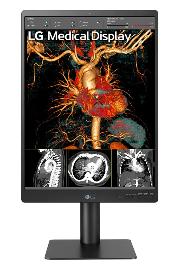 LG 21HQ513DS 21.3 Inch 3MP IPS Diagnostic Monitor