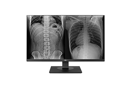 LG 27IN 3840X2160 IPS 8MP Clinical Review Monitor